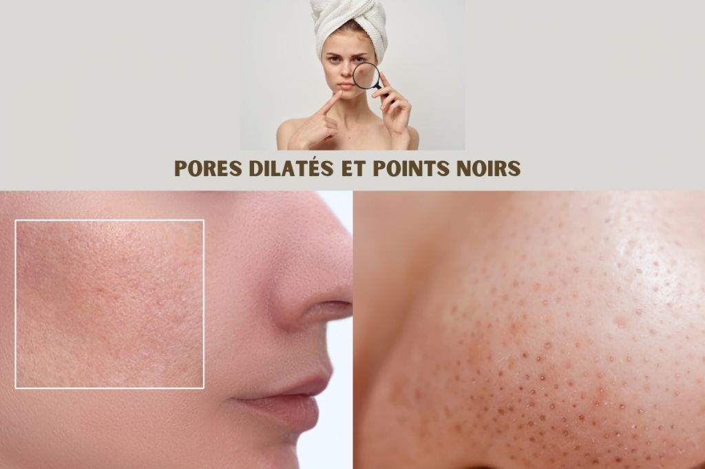 Comment éliminer points noirs et pores dilatés avec les cosmétiques Druide ?